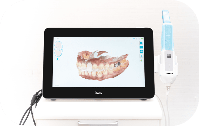 ハート・イン歯科クリニック iTero（3Dスキャナー）