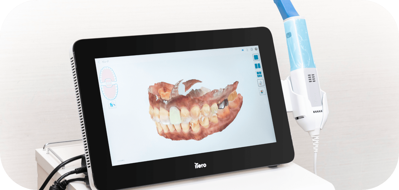 ハート・イン歯科クリニックの口腔内3Dスキャナー