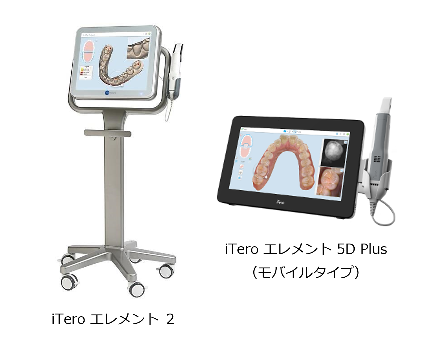 光学式口腔内スキャナー「iTero Element」 | 吉祥寺駅3分の歯医者 